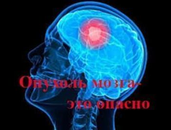 Стремление жить - Головная боль — опасный признак | Фонд Инна - Благотворительный фонд помощи онкобольным