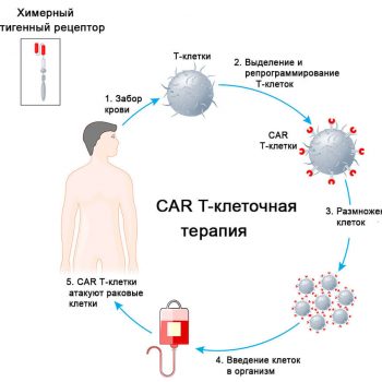 Desire to live - Leukemia is defeated. CAR-T therapy works! | Inna Foundation - Charity foundation for cancer