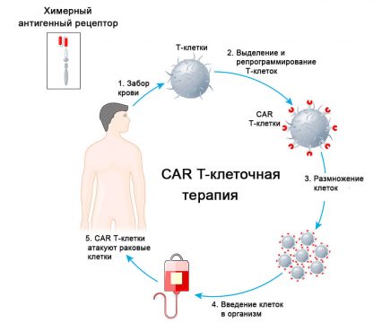 Desire to live - Leukemia is defeated. CAR-T therapy works! | Inna Foundation
