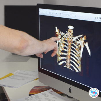 Новости - Фонд «Инна» оплатил КТ своим подопечным | Фонд Инна - Благотворительный фонд помощи онкобольным