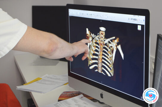 Новости - Фонд «Инна» оплатил КТ своим подопечным | Фонд Инна