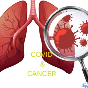 Стремление жить - COVID-19 усилил риск рака. ВИДЕО | Фонд Инна - Благотворительный фонд помощи онкобольным